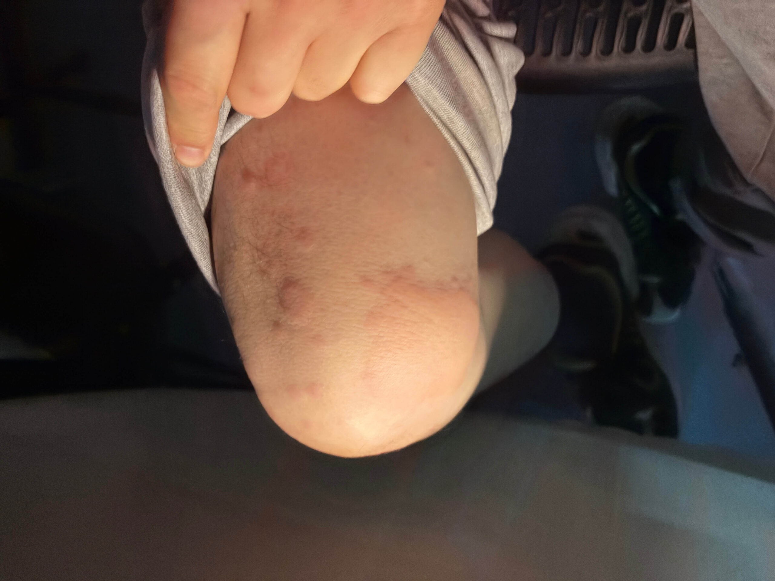 泰国生病故事(2026/3/6)